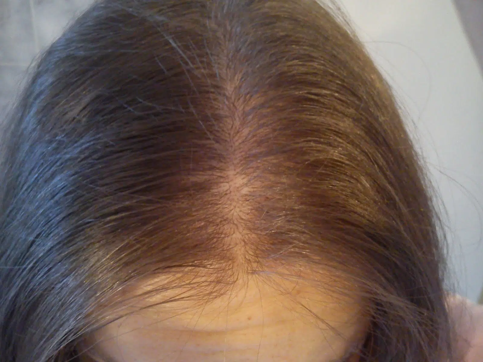 chute cheveux